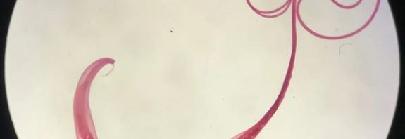 Antik Viking Kakası Gösterdi ki; Bağırsak Solucanları İnsanlığın En Yakın Arkadaşı