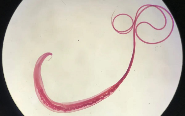 Antik Viking Kakası Gösterdi ki; Bağırsak Solucanları İnsanlığın En Yakın Arkadaşı