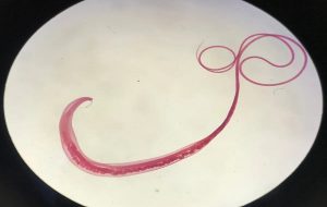 Ancient Viking Poop Shows How Gut Worms Are Humankind's Closest Companion