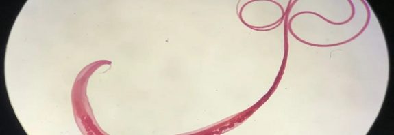 Ancient Viking Poop Shows How Gut Worms Are Humankind's Closest Companion