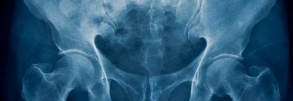 What makes us human? It’s all in the hips