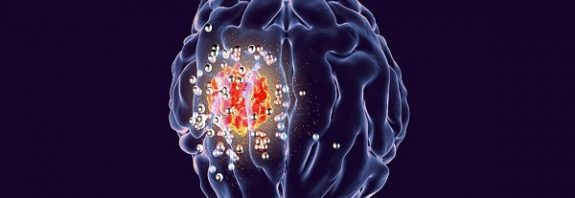 A small wireless implant could help kill deadly brain tumors