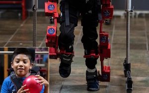 Ömür Boyu Tekerlekli Sandalyeye Mahkum Oldu; Robotik İskeletle İlk Adımını Attı