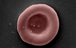 Lab-grown blood cells transfused into two patients in a world-first clinical trial