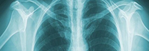 Your Bones May Never Be The Same Again After Having Children