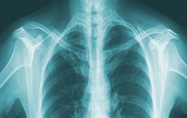 Your Bones May Never Be The Same Again After Having Children