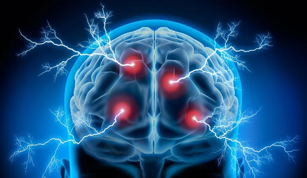 Ön Yargılara Rağmen Elektroşok, Depresyon Tedavisinde Daha Başarılıdır