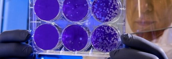 Bilim İnsanları Virüsün Bir Kişiye Saldırdığı Anı Videoya Kaydetti