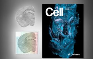 Türk Doktor Geliştirdiği Robotik Sistemle Dünyada Bir İlke İmza Attı