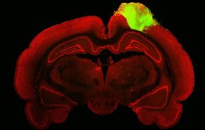 İnsan Nöronları Fare Beyniyle Kaynaştı ve Uyaranlara Tepki Verdi