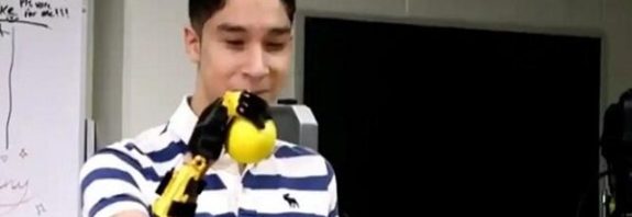 Doğuştan Engelli Bir Öğrenci İçin Sınıf Arkadaşları Robotik Kol Tasarladı