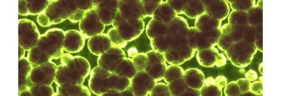 Newly discovered enzyme that turns air into electricity, providing a new clean source of energy