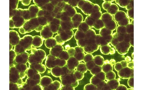 Newly discovered enzyme that turns air into electricity, providing a new clean source of energy