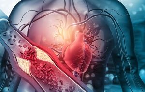 New cell therapy for chronic heart failure actually works, here is how