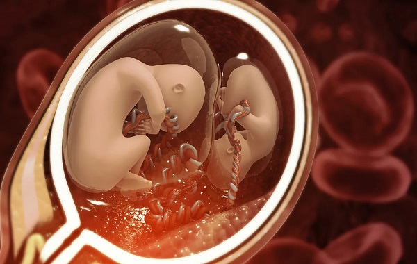 Rare surgery: Unborn twin removed from brain of 1-year-old in China