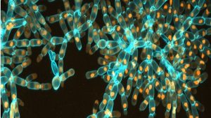 Tek Hücreli Bir Maya Nasıl Çok Hücreli Bir Canlıya Dönüştü?