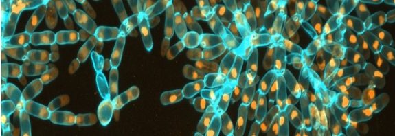 Tek Hücreli Bir Maya Nasıl Çok Hücreli Bir Canlıya Dönüştü?