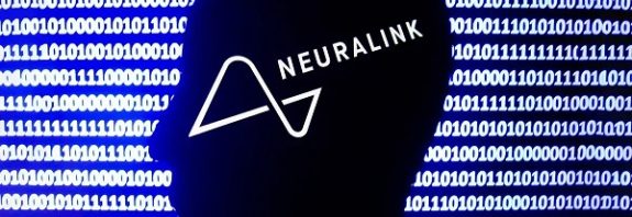 Elon Musk’s Neuralink says FDA has given nod to kickstart first human trials