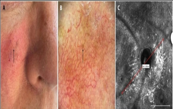 Dünyanın En Küçük Cilt