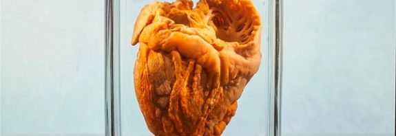 Çıkarıldıktan 16 Yıl