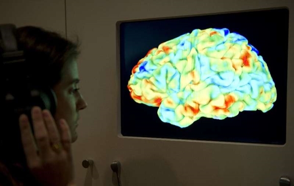 Bilim İnsanları fMRI