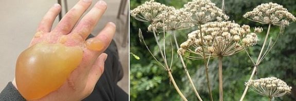 Yabani Tavşancıl Otuna Bir Anlık Temas Bile Çok Acı Verici Olabilir