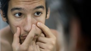 Acne-Causing Bacteria May Actually Be Vital For Healthy Skin