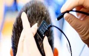 Amazing Brain Implant Gives a Voice to People Who Couldn't Speak For Years