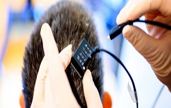 Amazing Brain Implant Gives a Voice to People Who Couldn't Speak For Years