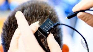 İnanılmaz Beyin İmplantı Yıllardır Konuşamayan İnsanlara Ses Veriyor