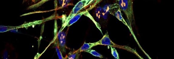 Aggressive Cancer Cells Transformed Into Healthy Cells in Breakthrough