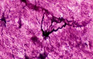 Strange 'Hybrid' Brain Cells Have Been Discovered Hiding Inside Our Heads