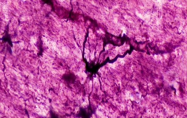 Strange 'Hybrid' Brain Cells Have Been Discovered Hiding Inside Our Heads