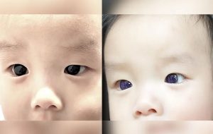 Infant's dark-brown eyes suddenly turn indigo blue after COVID-19 antiviral treatment. But why?