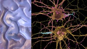 Laboratuvarda Üretilen Dopamin Nöronları Parkinson Hastalığının Tedavisinde Yeni Umut Kapısı Açıyor
