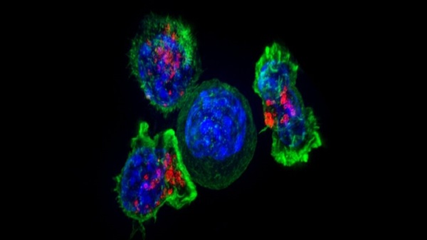 Bağırsak Kanserini Durdurmanın Anahtarı Bağışıklık Hücreleriyle Yeni Tedavi Yolu Keşfedildi