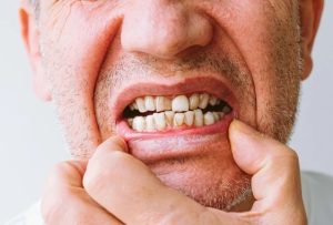 Scientists begin human trials for drug that can regrow teeth: 'Every dentist's dream'