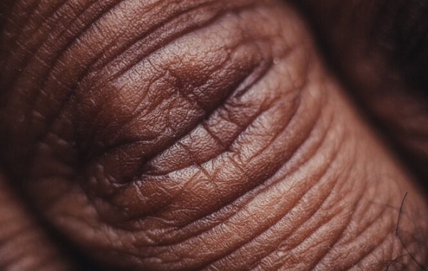 Tam Kalınlıkta İnsan Derisi Oluşturmak İçin Biyobaskı Kullandı