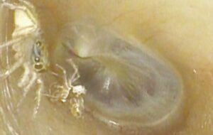 Horrifying video reveals molting spider rustling in woman's ear