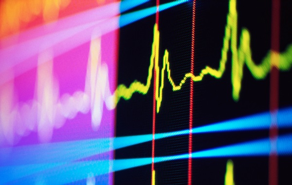 New 'Remarkable Connection' Discovered Between Our Heart And Brain