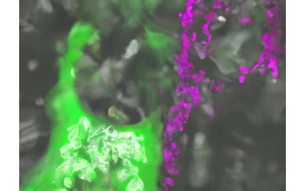 The genetic heritage of the Denisovans may have left its mark on our mental health