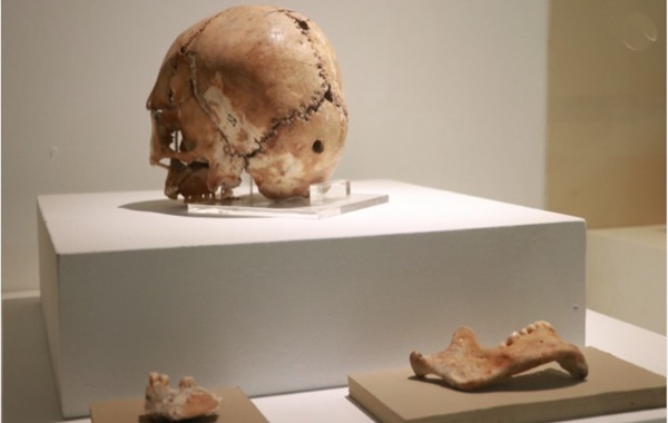 Dünyanın İlk Beyin Ameliyatı