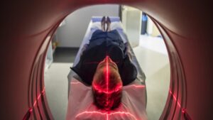 Hafızayı Kaybetmenin Yeni Nedeni: Enjeksiyonlarla Bulaşan Alzheimer