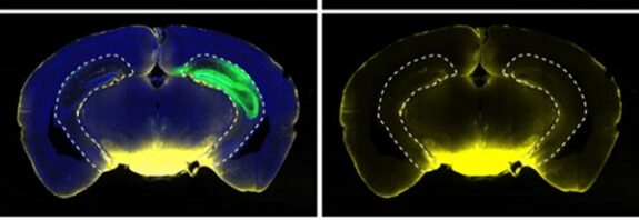 Gizli Dalgalar Siz Uyurken Beyninizdeki Sıvıyı Yıkıyor