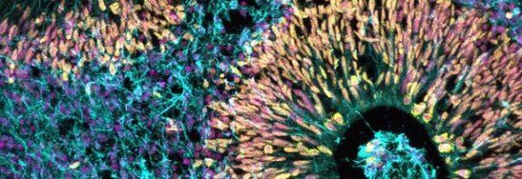 Şaşırtıcı Şekilde Hamilelikteki Stres Hormonu Bebeğin Gelişimine Katkı Sağlıyor