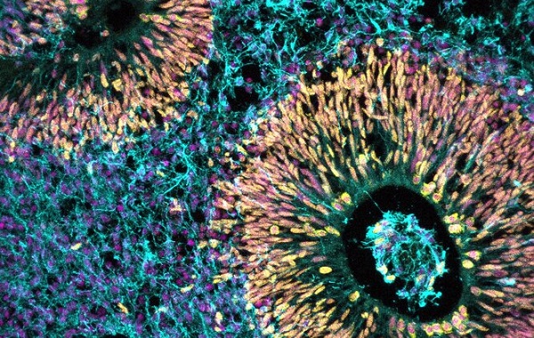 Şaşırtıcı Şekilde Hamilelikteki Stres Hormonu Bebeğin Gelişimine Katkı Sağlıyor