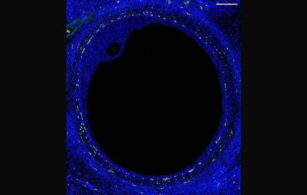 Artificial ovary? First atlas of human ovary, a fertility breakthrough