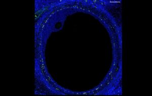 İnsan Hücre Atlası
