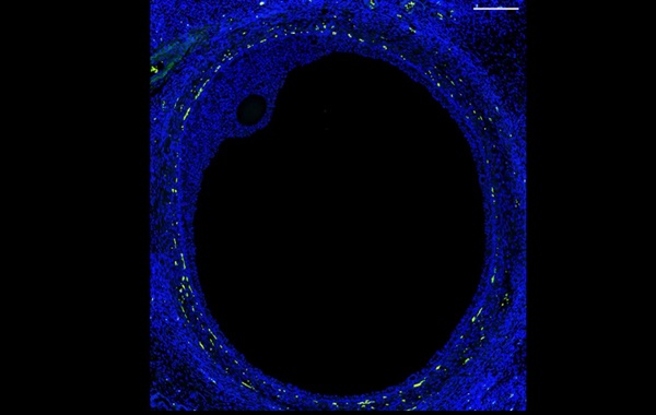 İnsan Hücre Atlası
