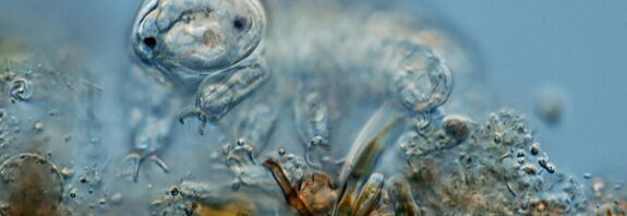 Tardigrad Proteinleri İnsan Hücrelerinin Yaşlanmasını Yavaşlatıyor